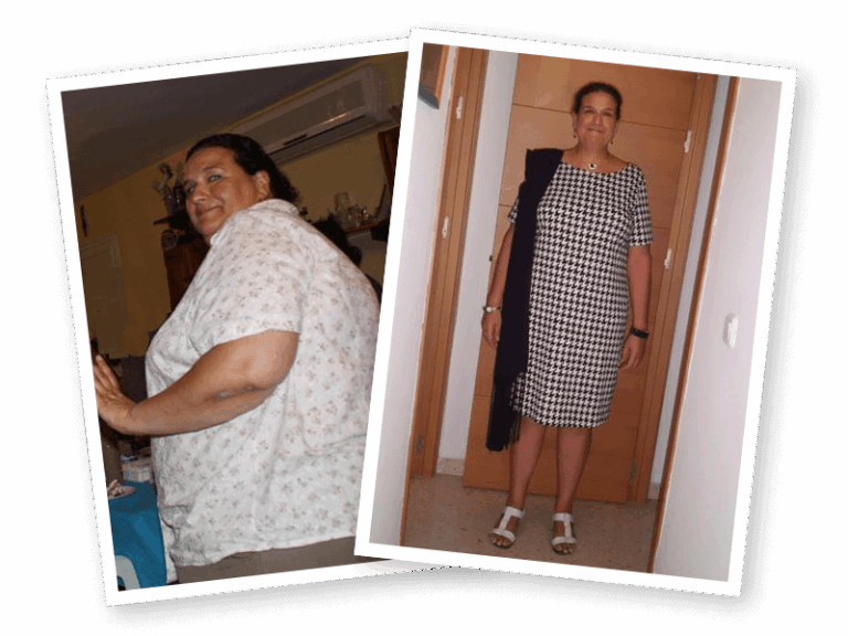 43 kilos totalmente reafirmada y sin estrías