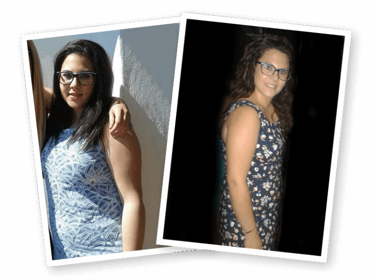 Con nuestro sistema de Adelgazamiento Estético perdió 15 kilos