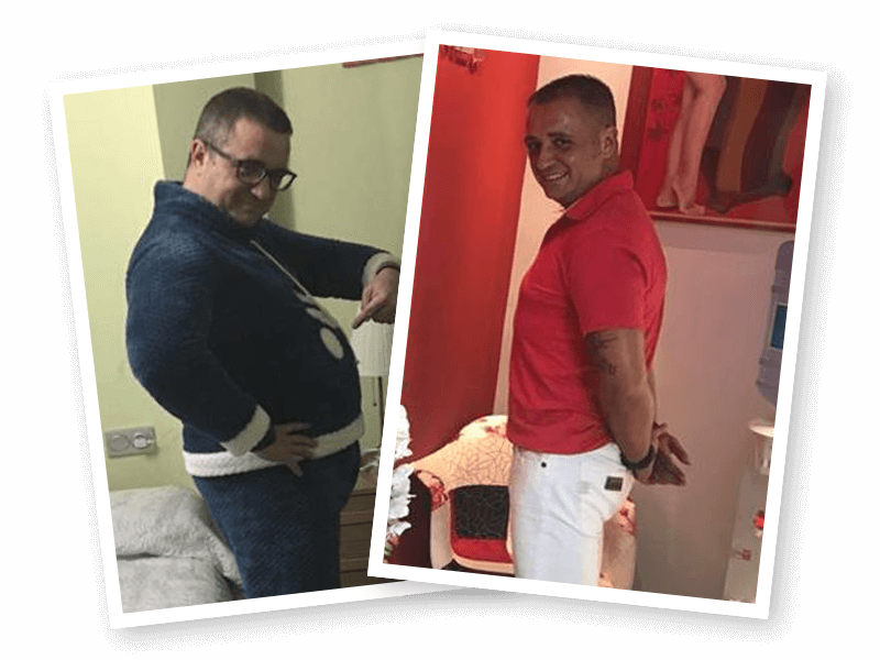 20 cm menos de abdomen sin efecto rebote